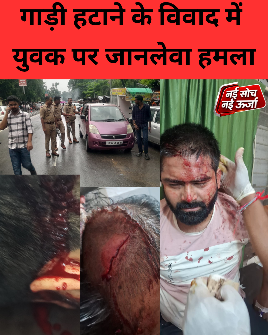 lucknow-krishnanagar-youth-attack-cctv